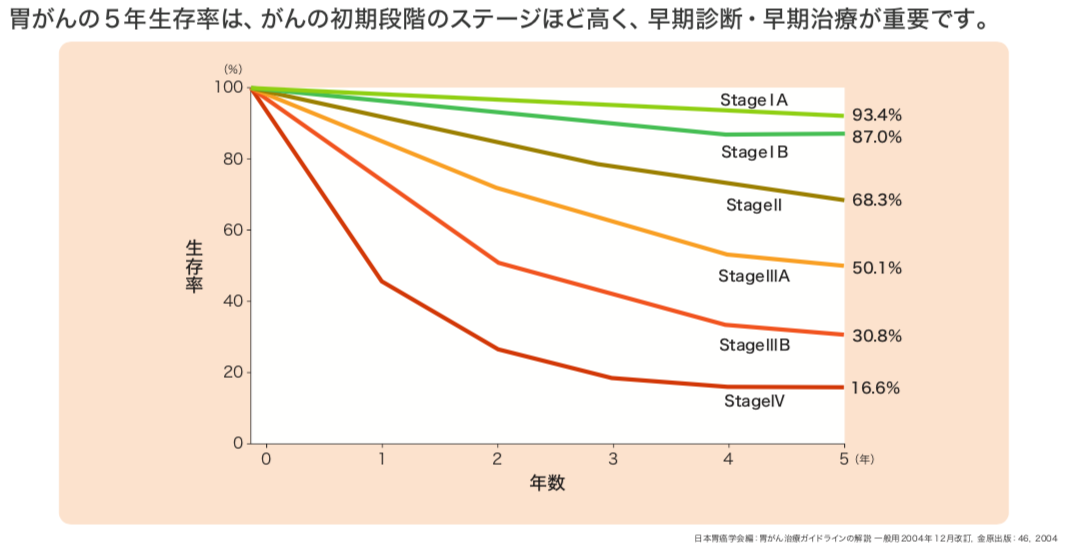 胃がん ステージ 4 生存 率